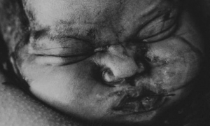 Prekrasne fotografije s poroda koje prenose emocije
