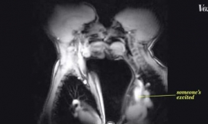 Ovako izgledaju intimni dodiri unutar MRI skenera